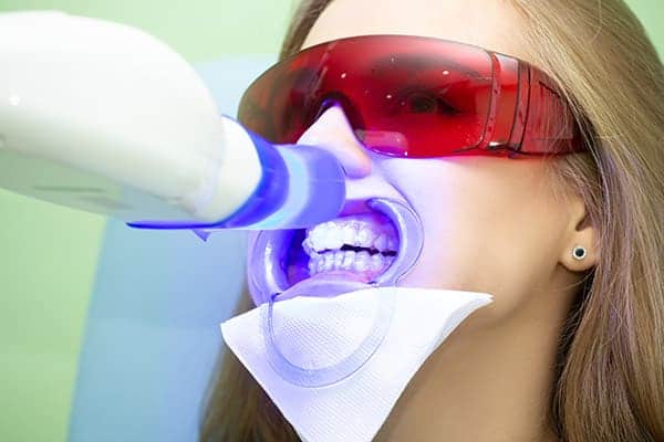 Laser teeth whitening treatments Leicestershire