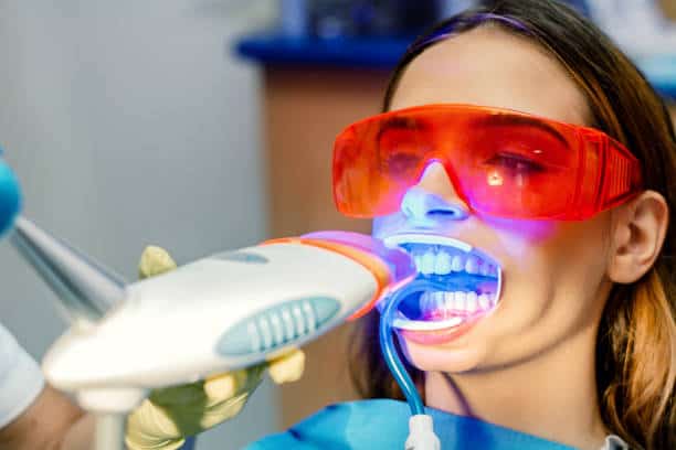 Simplifying Teeth Whitening: A Comprehensive Guide Leicestershire