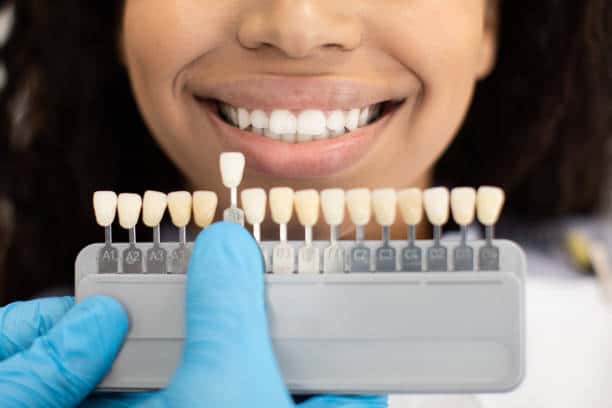 Laser Teeth Whitening: Exploring the Longevity of Your Brighter Smile Leicestershire