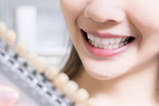 Teeth Whitening Kings Norton Leicestershire