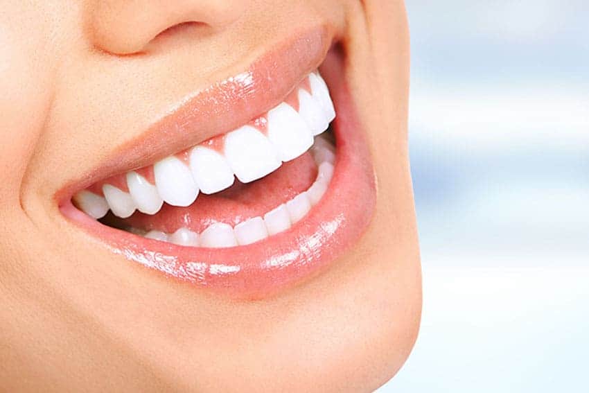 Teeth Whitening Abingdon Leicestershire