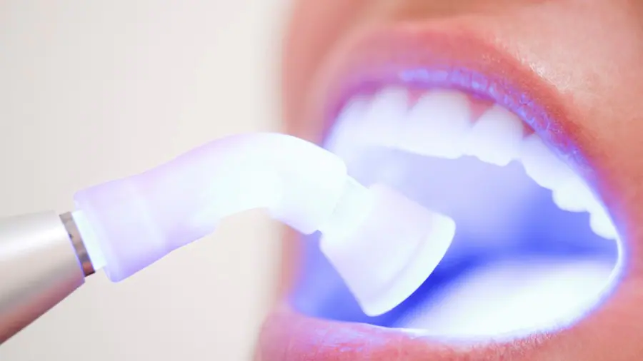 Teeth Whitening Aylesbury Leicestershire