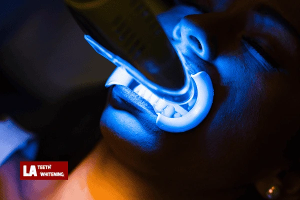 Is Laser Whitening Bad For You? Leicestershire